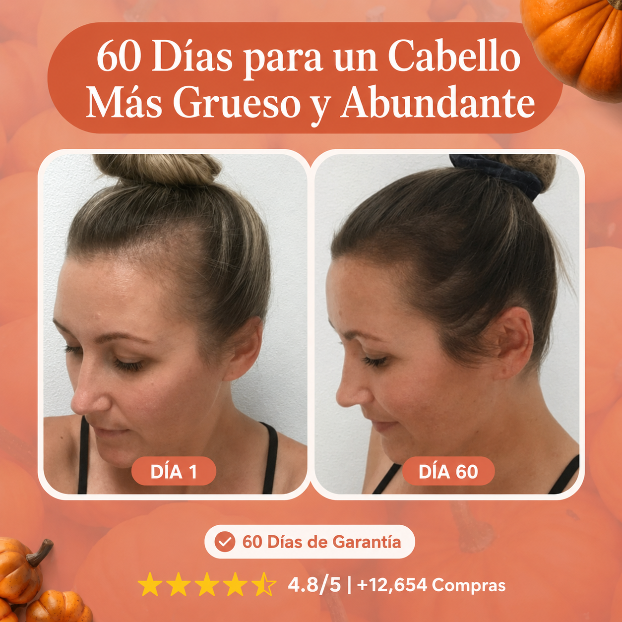 Menor caída de pelo en 26 días o menos.
