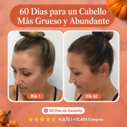 Menor caída de pelo en 26 días o menos.