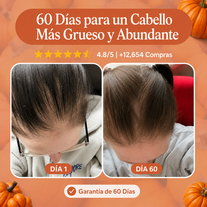 Menor caída de pelo en 26 días o menos.